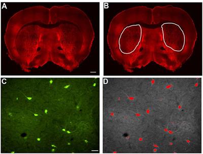 BACHD Mice Recapitulate the Striatal Parvalbuminergic Interneuron Loss Found in Huntington’s Disease